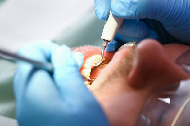 24-Hour Dental Clinic Near Me in NC