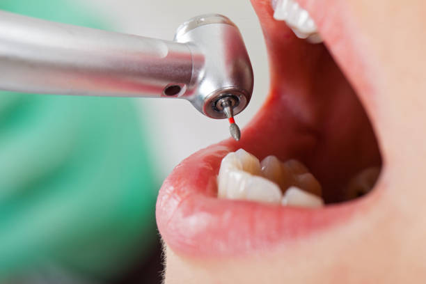 Best Urgent Tooth Repair  in Hays, NC